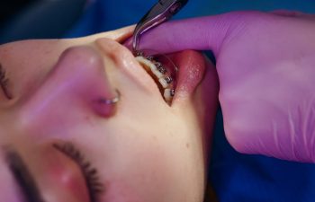 Jak znaleźć dobrego ortodontę współpracującego z NFZ?